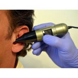 Otoscop USB portabil - Earscope - Microscop ORL Otoscop USB portabil - Earscope - Microscop ORL